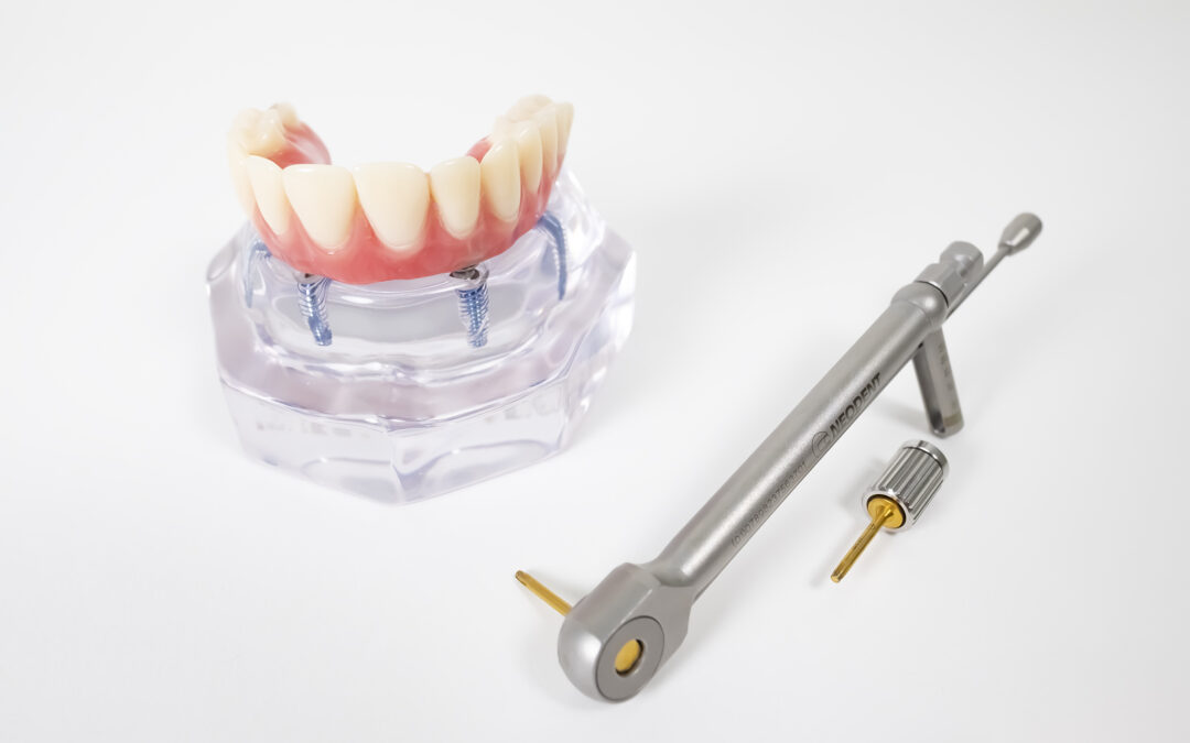 10 najčastejších otázok a odpovedí po zavedení zubných implantátov
