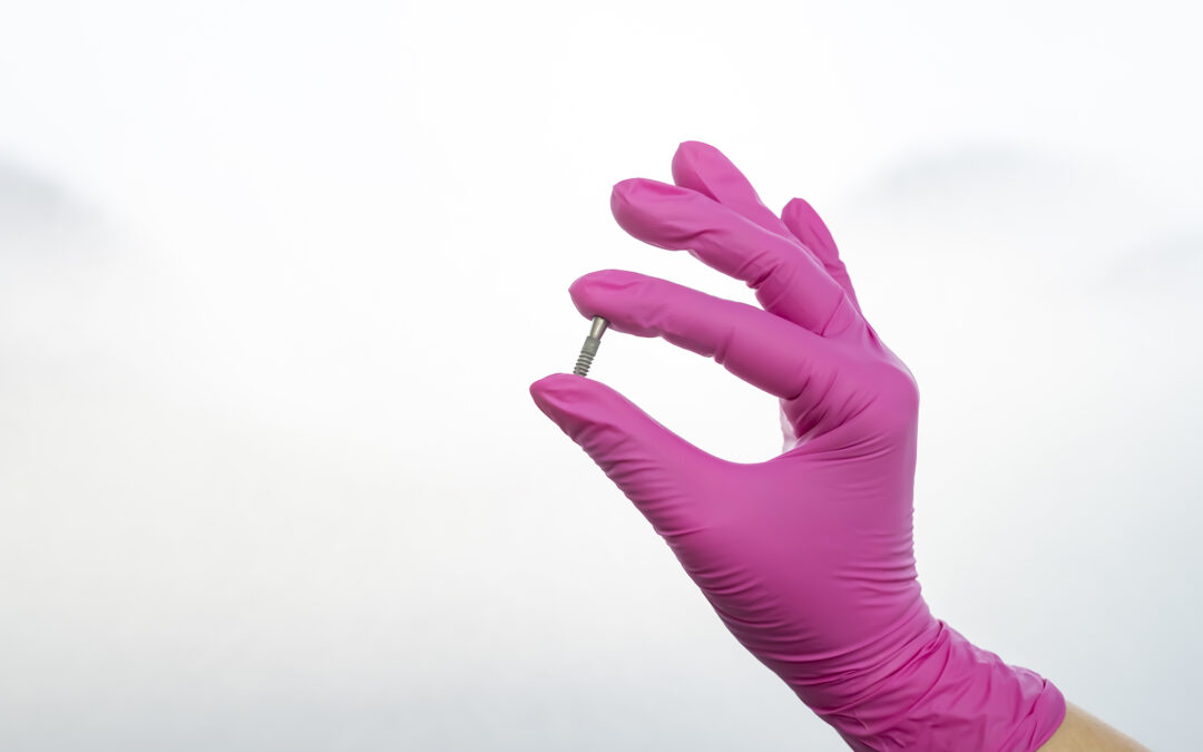 Bolí zavedenie zubného implantátu? A čo s bolesťou po zákroku?