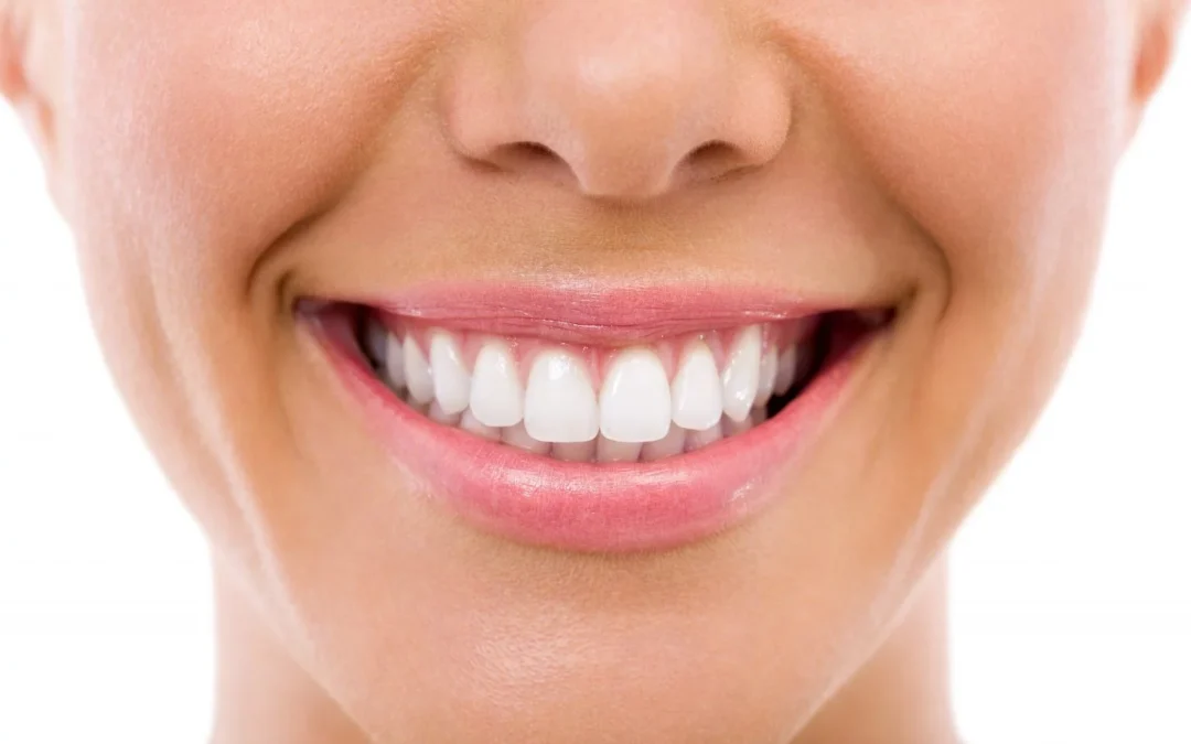 All-on-4 a All-on-6 zubné implantáty